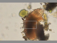 Echiniscidae
