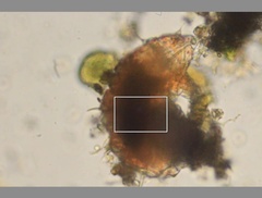Echiniscidae