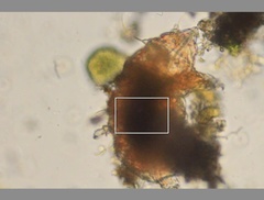 Echiniscidae