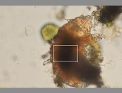 Echiniscidae