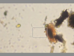 Echiniscidae