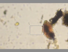 Echiniscidae