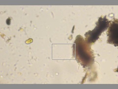 Echiniscidae