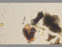 Echiniscidae