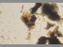 Echiniscidae