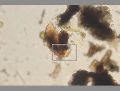 Echiniscidae