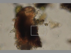 Echiniscidae
