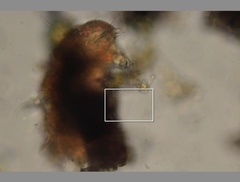 Echiniscidae