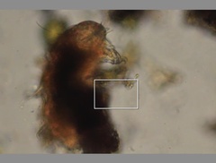 Echiniscidae