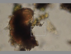 Echiniscidae