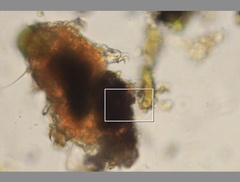 Echiniscidae