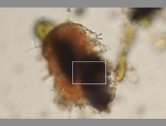 Echiniscidae