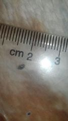 Anthrenus verbasci