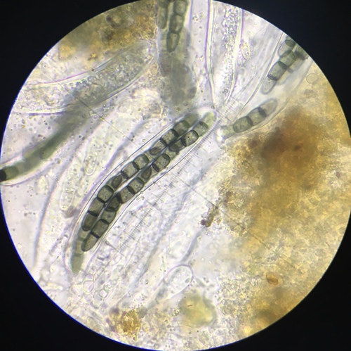 Representative image of Sporormiella isomera