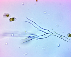 Dinobryon pediforme