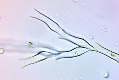 Dinobryon pediforme