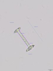 Heterorotula multidentata