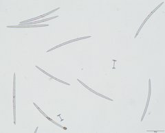 Heterorotula contraversa