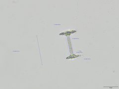 Heterorotula contraversa