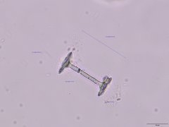 Heterorotula contraversa