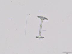 Heterorotula contraversa