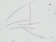 Heterorotula multidentata
