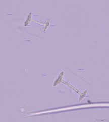 Heterorotula multidentata