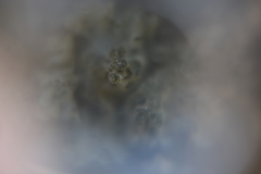 Phaeophyscia ciliata