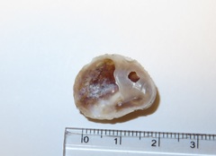 Bostrycapulus gravispinosus