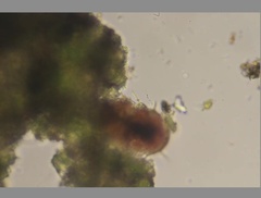 Echiniscidae