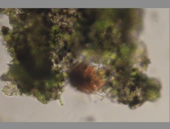 Echiniscidae