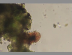Echiniscidae