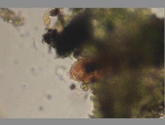 Echiniscidae