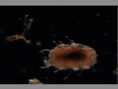 Echiniscidae
