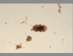 Echiniscidae