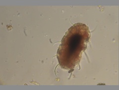 Echiniscidae