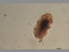 Echiniscidae