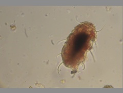 Echiniscidae