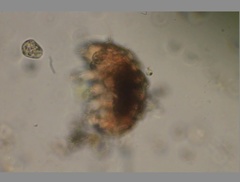 Echiniscidae