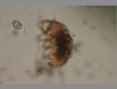 Echiniscidae