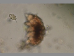 Echiniscidae