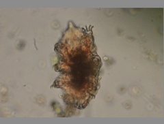 Echiniscidae