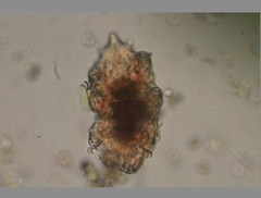 Echiniscidae