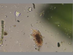 Echiniscidae