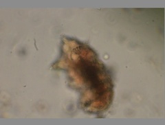 Echiniscidae