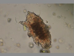 Echiniscidae