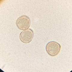 Puccinia pelargonii-zonalis