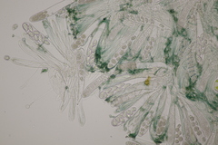 Mniaecia jungermanniae