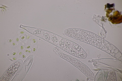 Mniaecia jungermanniae