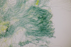 Mniaecia jungermanniae